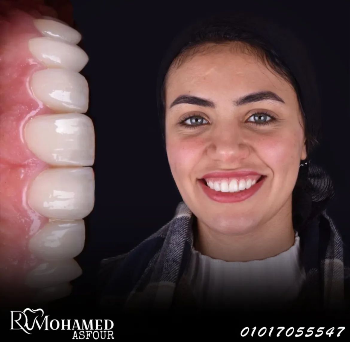 زراعة